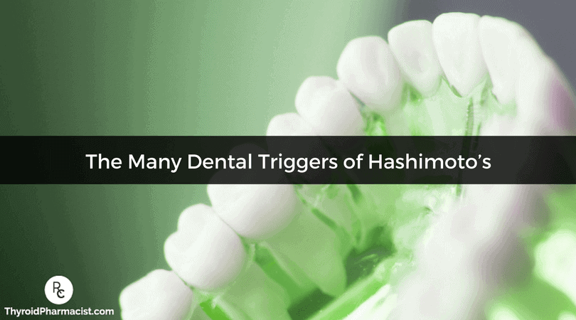 Is you Hashimoto's caused by dental issues? Discover triggers that you might not have even known about.