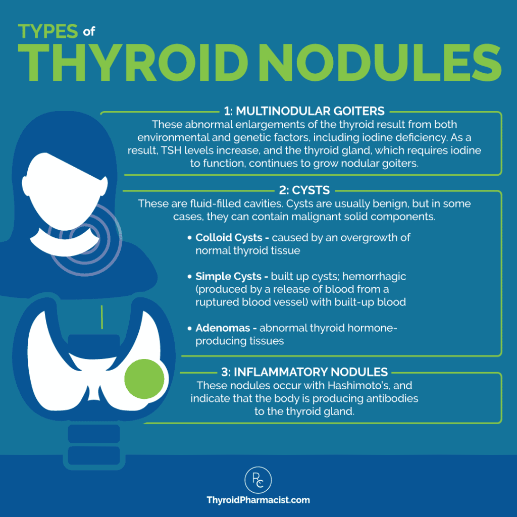 Types of Thyroid Nodules