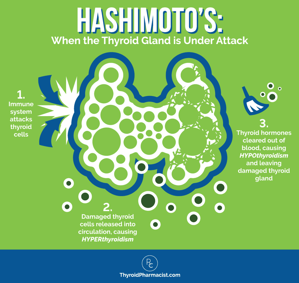 When the Thyroid Gland is Under Attack Infographic