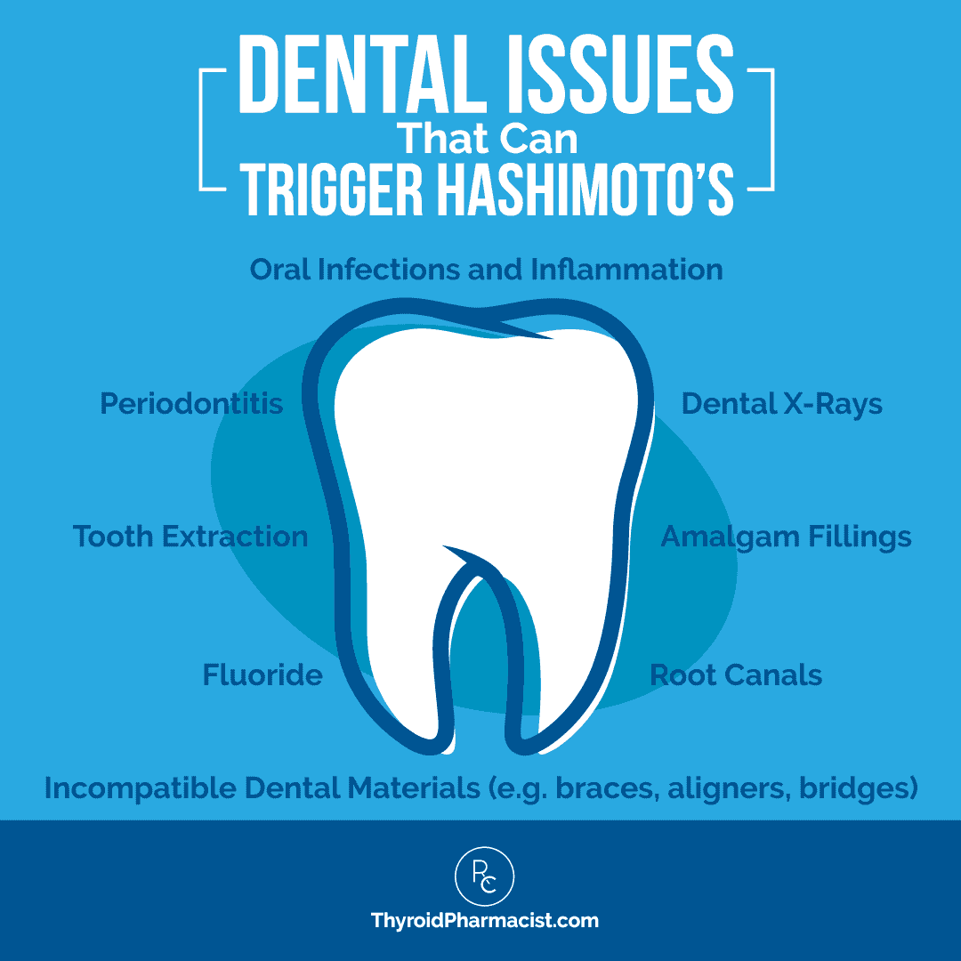 Dental Issues that can Trigger Hashimoto's