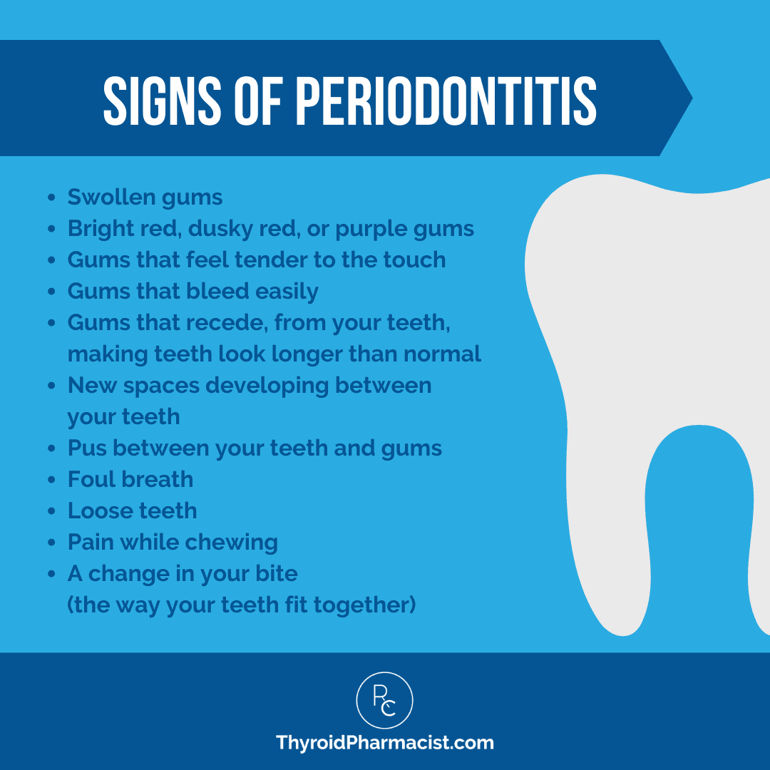 Signs of Periodontitis Infographic