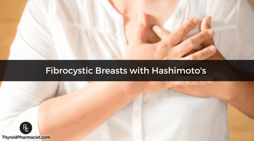 Approach to Fibrocystic Breasts with Hashimoto's