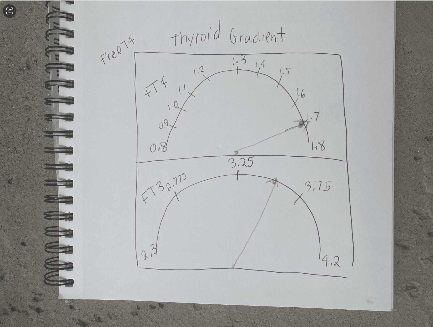T4 to T3 Thyroid Gradient