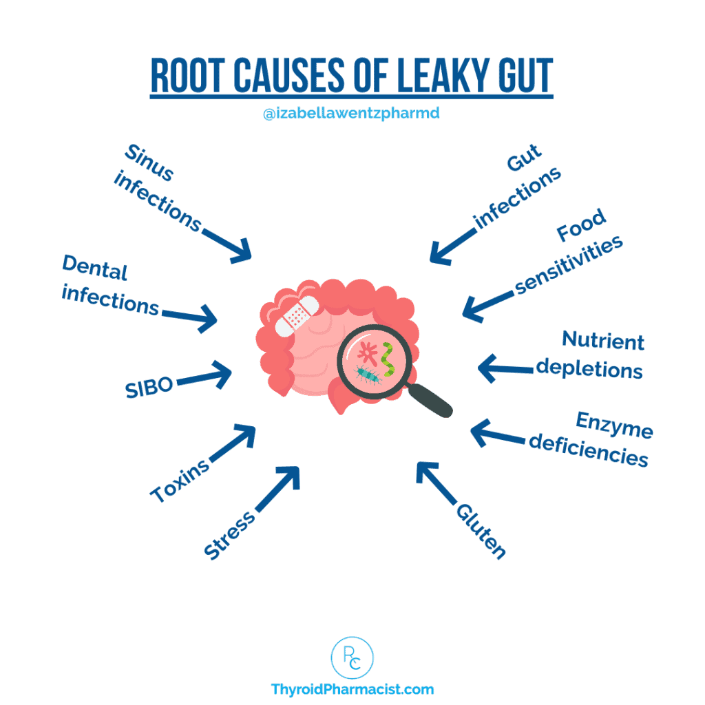 Root Causes of Leaky Gut