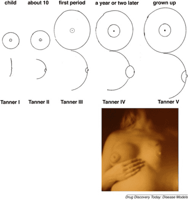 Tanner IV Stage breast
