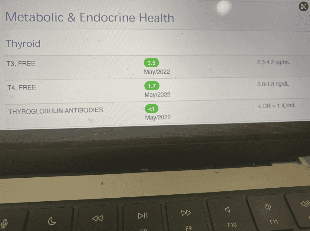 Ulta Free T4 T3 Lab Results